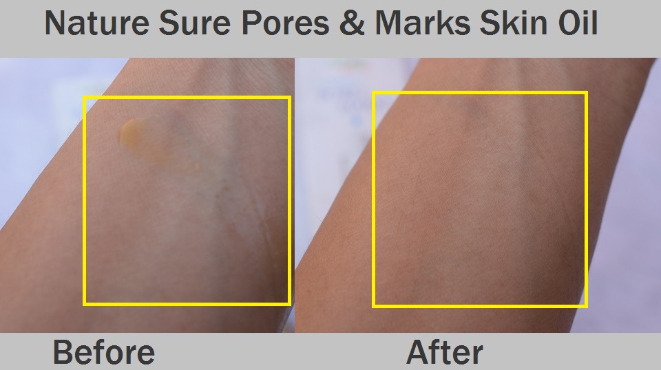 Nature Sure Pores & Marks Skin Oil Absorbs Fast