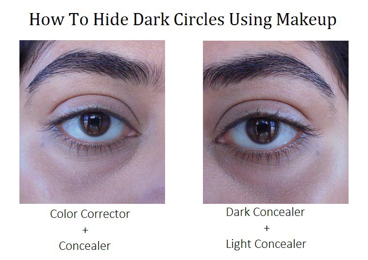 tromme sigte offentlig How To Hide Intense Dark Circles - Step By Step - High On Gloss